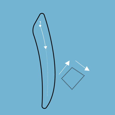 button